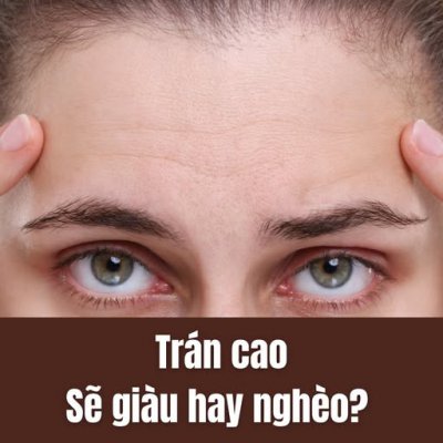 RÁN CAO – DẤU HIỆU TRÍ TUỆ HAY LỜI HỨA GIÀU SANG?